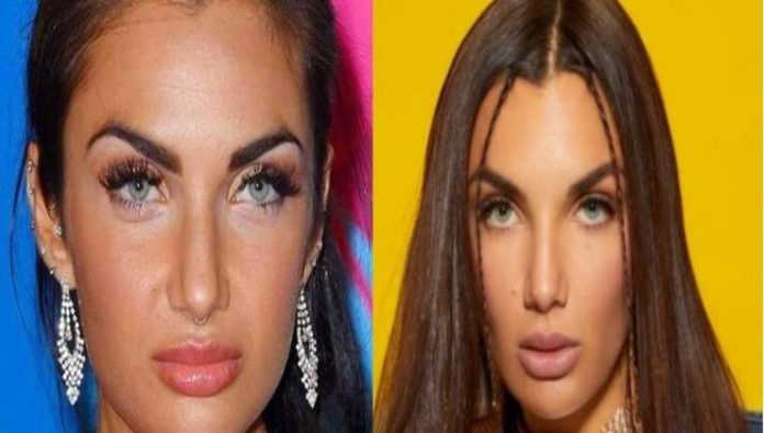Elettra Lamborghini Seno Prima E Dopo