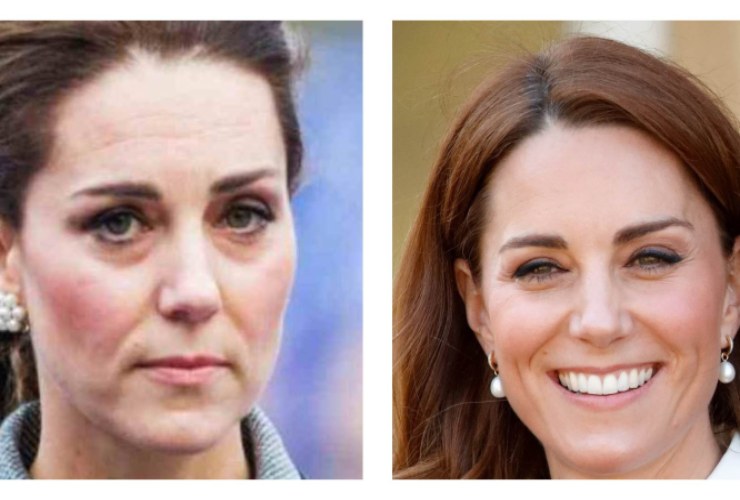 Kate Middleton confronto - 18082022 - political24